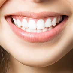 Professional Teeth Whitening in North Olmsted