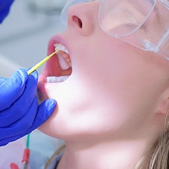 Professional Dental Whitening Near You